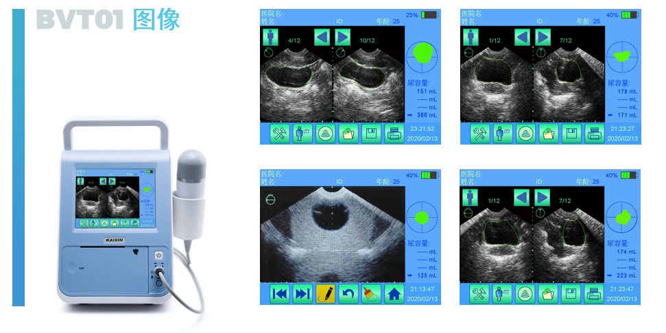 超聲膀胱掃描儀的原理介紹和產(chǎn)品特點(diǎn)