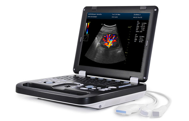 DCU50 獸用便攜式彩超機(jī),便攜彩超機(jī)多少錢